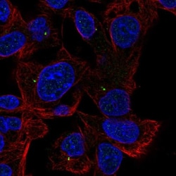 ALDH8A1 Antibody, Novus Biologicals 0.1mL; Unlabeled:Antibodies, Polyclonal