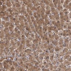 ALDH8A1 Antibody, Novus Biologicals 25 &mu;L | Buy Online | Novus Biologicals | Fisher Scientific