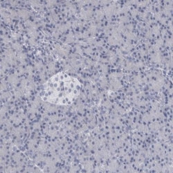 ALDH8A1 Antibody, Novus Biologicals 25 &mu;L | Buy Online | Novus Biologicals | Fisher Scientific