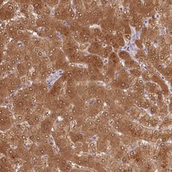 ALDH8A1 Antibody, Novus Biologicals 0.1mL; Unlabeled:Antibodies, Polyclonal