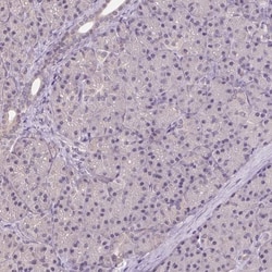 ALDH8A1 Antibody, Novus Biologicals 0.1mL; Unlabeled:Antibodies, Polyclonal