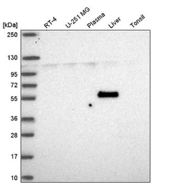 ALDH8A1 Antibody, Novus Biologicals 0.1mL; Unlabeled:Antibodies, Polyclonal