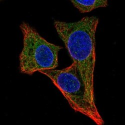 ALG1 Antibody, Novus Biologicals:Antibodies:Primary Antibodies