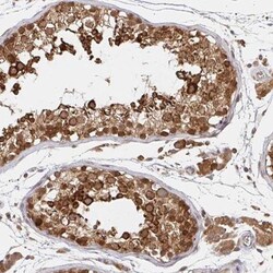 ALG1 Antibody, Novus Biologicals:Antibodies:Primary Antibodies