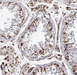 ALG1L Antibody, Novus Biologicals 25 &mu;L; Unlabeled:Antibodies, Polyclonal