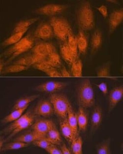 ALK-1 Rabbit anti-Human, Mouse, Rat, Clone: 8L2V7, Novus Biologicals 100