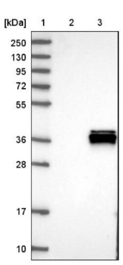 ALKBH3 Antibody, Novus Biologicals 0.1mL; Unlabeled:Antibodies, Polyclonal