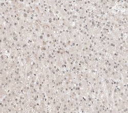 ALKBH5 Antibody, Novus Biologicals:Antibodies:Primary Antibodies