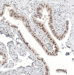 ALKBH5 Antibody, Novus Biologicals:Antibodies:Primary Antibodies