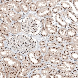 ALKBH5 Antibody, Novus Biologicals:Antibodies:Primary Antibodies
