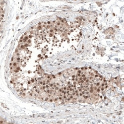 ALKBH5 Antibody, Novus Biologicals:Antibodies:Primary Antibodies