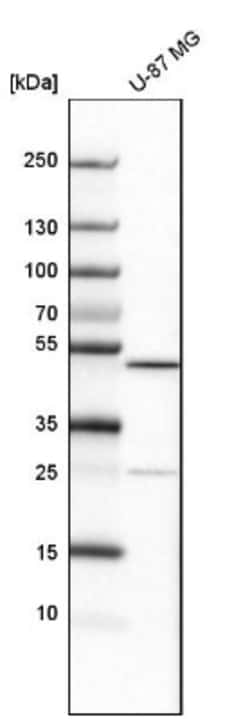 ALKBH5 Antibody, Novus Biologicals:Antibodies:Primary Antibodies