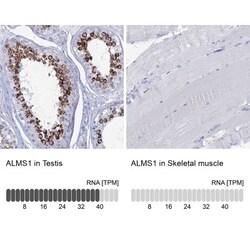 ALMS1 Antibody, Novus Biologicals 25 &mu;L; Unlabeled:Antibodies, Polyclonal
