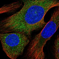ALOX12B Antibody, Novus Biologicals 0.1mL; Unlabeled:Antibodies, Polyclonal