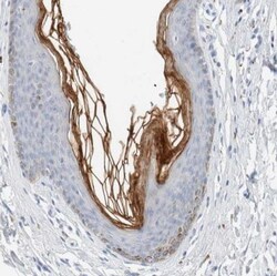 ALOX12B Antibody, Novus Biologicals 0.1mL; Unlabeled:Antibodies, Polyclonal