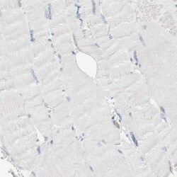 ALOX12B Antibody, Novus Biologicals 0.1mL; Unlabeled:Antibodies, Polyclonal