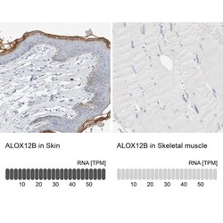 ALOX12B Antibody, Novus Biologicals 0.1mL; Unlabeled:Antibodies, Polyclonal
