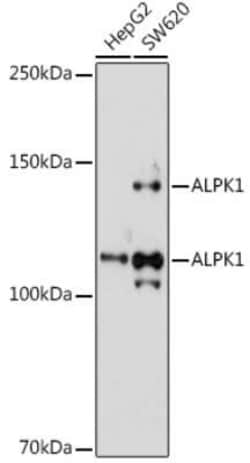 ALPK1 Rabbit anti-Human, Polyclonal, Novus Biologicals 100 &mu;g; Unconjugated:Antibodies,