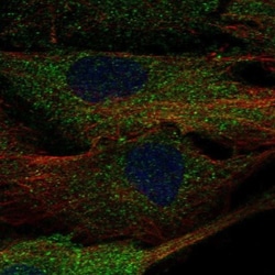ALPK2 Antibody, Novus Biologicals:Antibodies:Primary Antibodies