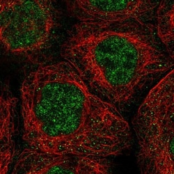 ALPK2 Antibody, Novus Biologicals:Antibodies:Primary Antibodies