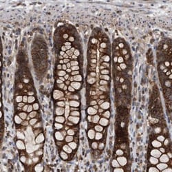 ALPK2 Antibody, Novus Biologicals:Antibodies:Primary Antibodies