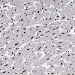 ALPK3 Antibody, Novus Biologicals:Antibodies:Primary Antibodies
