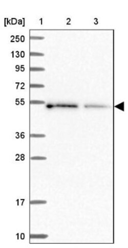 ALS2CR15 Antibody, Novus Biologicals 0.1mL; Unlabeled:Antibodies, Polyclonal