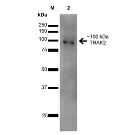 ALS2CR3 Antibody (S390-43), Novus Biologicals:Antibodies:Primary Antibodies