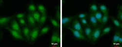 ALS2CR3 Antibody, Novus Biologicals 0.1mL; Unlabeled:Antibodies, Polyclonal