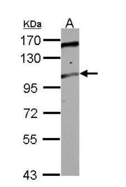 ALS2CR3 Antibody, Novus Biologicals 0.1mL; Unlabeled:Antibodies, Polyclonal