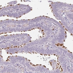 ALS2CR4 Antibody, Novus Biologicals:Antibodies:Primary Antibodies