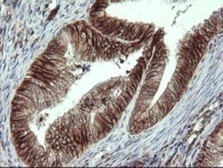 ALX4 Antibody (OTI6B3), Novus Biologicals 0.1mL; Unlabeled:Antibodies,
