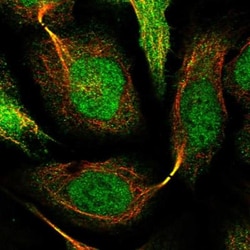 AMDHD2 Antibody, Novus Biologicals:Antibodies:Primary Antibodies