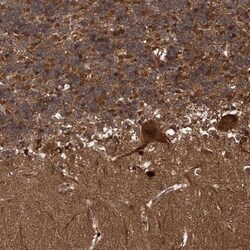 AMDHD2 Antibody, Novus Biologicals:Antibodies:Primary Antibodies