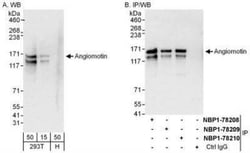 AMOT Antibody, Novus Biologicals 0.1mL; Unlabeled:Antibodies, Polyclonal