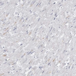 AMPD1 Antibody, Novus Biologicals:Antibodies:Primary Antibodies