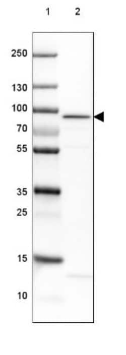 AMPD1 Antibody, Novus Biologicals:Antibodies:Primary Antibodies