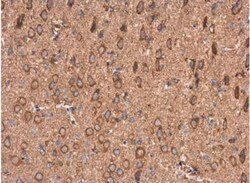 AMPD2 Antibody, Novus Biologicals 0.1 mL | Buy Online | Novus Biologicals | Fisher Scientific