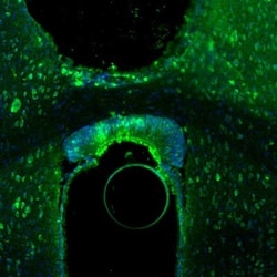 AMPD2 Antibody, Novus Biologicals 25 μL; Unlabeled:Antibodies, Polyclonal