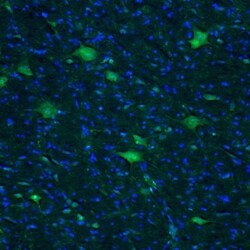 AMPD2 Antibody, Novus Biologicals 25 μL; Unlabeled:Antibodies, Polyclonal