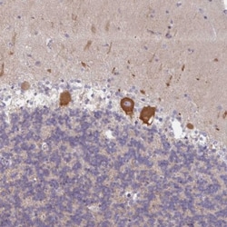 AMPD2 Antibody, Novus Biologicals 25 μL; Unlabeled:Antibodies, Polyclonal