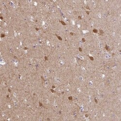 AMPD2 Antibody, Novus Biologicals 25 μL; Unlabeled:Antibodies, Polyclonal