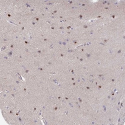 AMPD2 Antibody, Novus Biologicals 25 μL; Unlabeled:Antibodies, Polyclonal