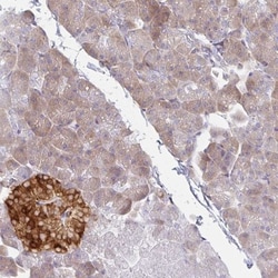 AMPD2 Antibody, Novus Biologicals 25 μL; Unlabeled:Antibodies, Polyclonal