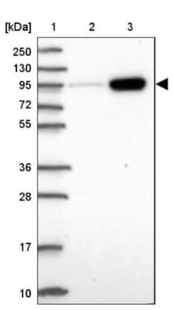 AMPD2 Antibody, Novus Biologicals 25 μL; Unlabeled:Antibodies, Polyclonal