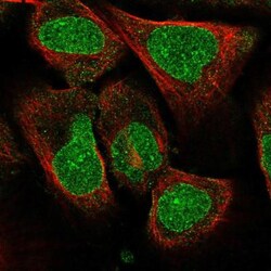AMPD3 Antibody, Novus Biologicals:Antibodies:Primary Antibodies