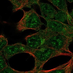 AMPK alpha 2 Antibody, Novus Biologicals 25 &mu;L, Unlabeled:Antibodies,