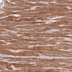 AMPK alpha 2 Antibody, Novus Biologicals 25 &mu;L, Unlabeled:Antibodies,