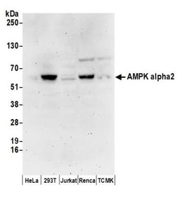 AMPK alpha 2 Antibody, Novus Biologicals 100 &mu;L | Buy Online | Novus Biologicals | Fisher Scientific