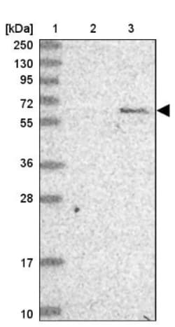 AMPK alpha 2 Antibody, Novus Biologicals 25 &mu;L, Unlabeled:Antibodies,